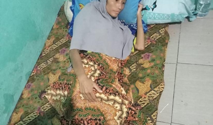 Tampak Pengidap Tumor yang dibantu Pemkab Mukomuko